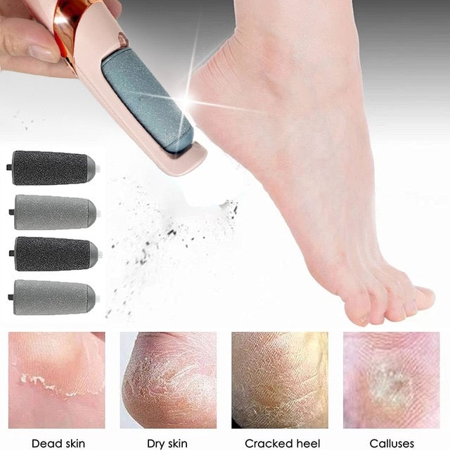 Rechargeable Electric Callus Remover – FREE Extra Roller + USB Charging Wire Included